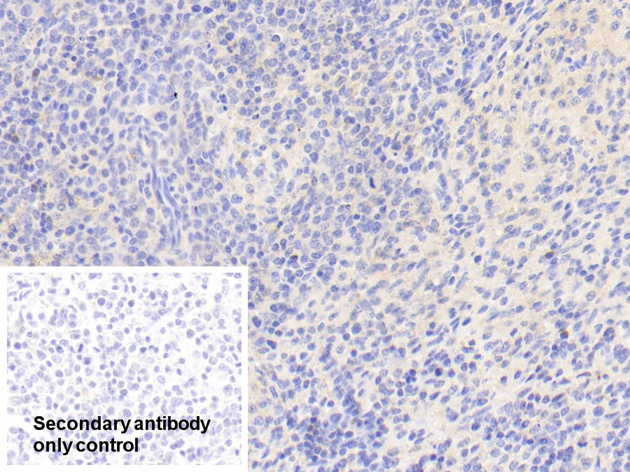 Anti-Vinculin (VCL) Polyclonal Antibody