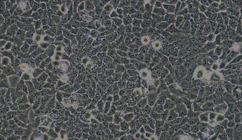 Human Bladder Carcinoma Cells (BCC)