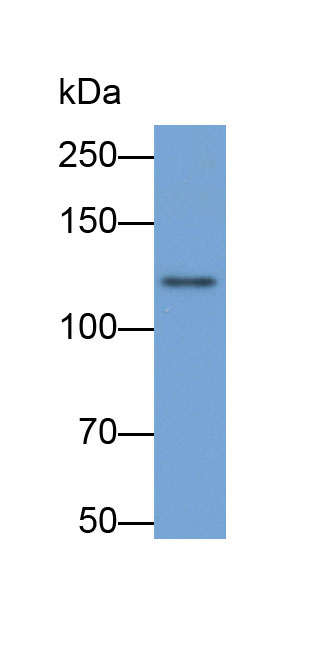 Biotin-Linked Polyclonal Antibody to Leukemia Inhibitory Factor Receptor (LIFR)