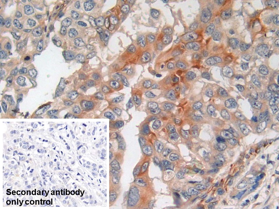 Monoclonal Antibody to Amphiregulin (AREG)
