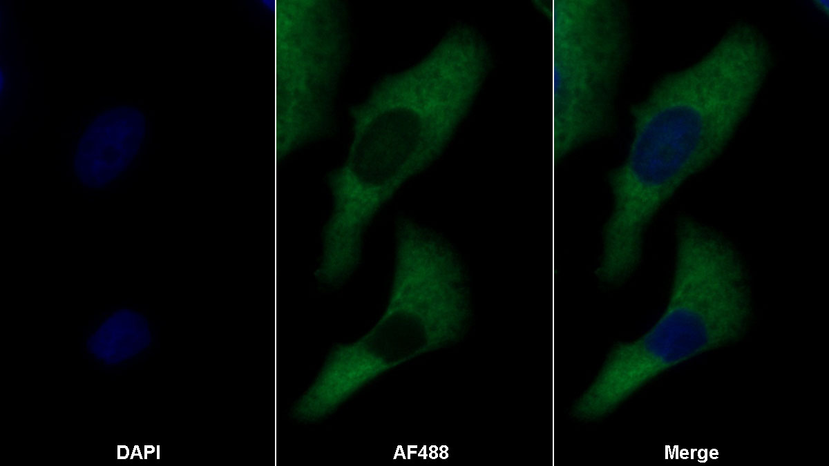 Monoclonal Antibody to Amphiregulin (AREG)