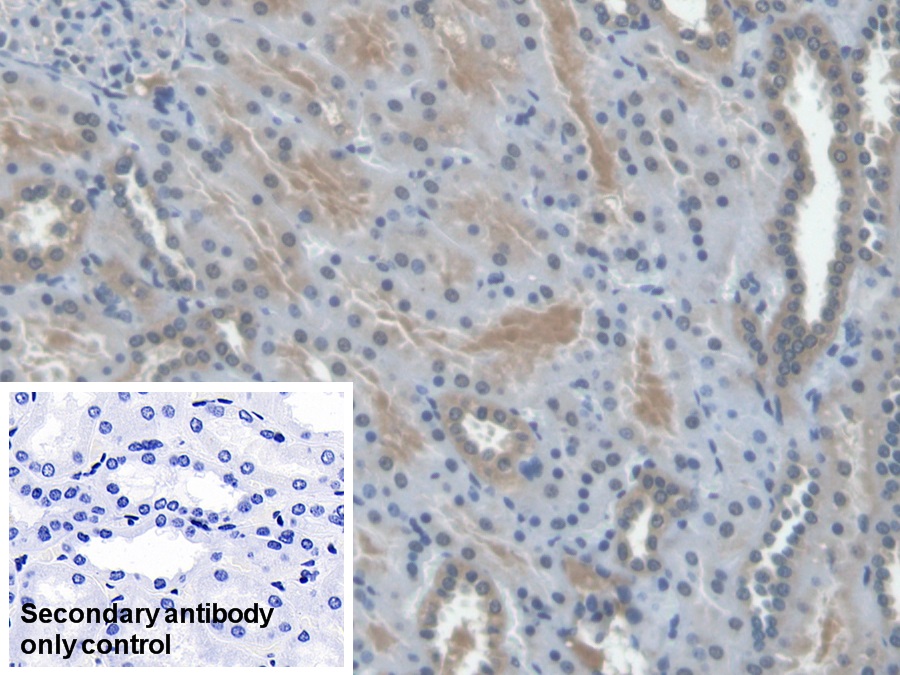 Monoclonal Antibody to Erythropoietin (EPO)