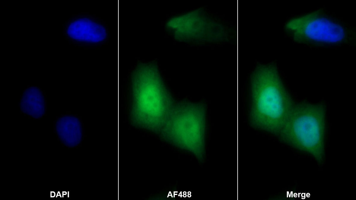 Monoclonal Antibody to Fibroblast Growth Factor 1, Acidic (FGF1)