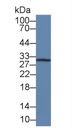 Monoclonal Antibody to Interleukin 12A (IL12A)