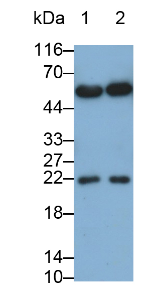 Monoclonal Antibody to Interleukin 15 (IL15)