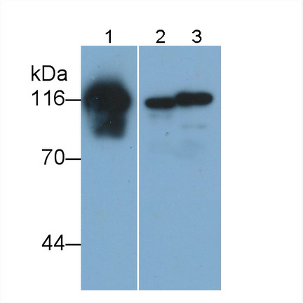 Monoclonal Antibody to Cadherin 5 (CDH5)