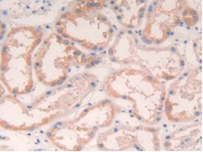 Polyclonal Antibody to Interleukin 4 (IL4)