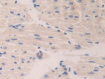 Polyclonal Antibody to Cathepsin A (CTSA)