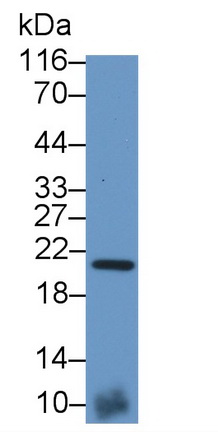 Polyclonal Antibody to Natriuretic Peptide Precursor B (NPPB)