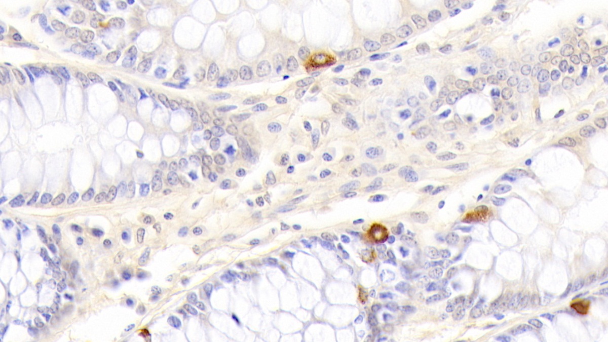 Polyclonal Antibody to Death receptor 5 (DR5)