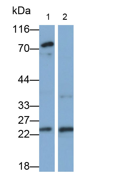 Polyclonal Antibody to Tumor Necrosis Factor Ligand Superfamily, Member 14 (TNFSF14)