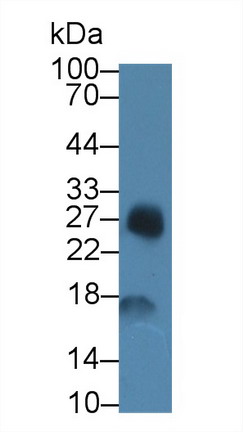 Polyclonal Antibody to Serum Amyloid A (SAA)