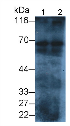 Polyclonal Antibody to Albumin (ALB)