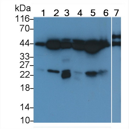 Polyclonal Antibody to c-Jun N-terminal Kinase 1 (JNK1)
