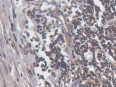 Polyclonal Antibody to Perforin 1 (PRF1)