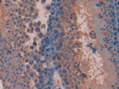 Polyclonal Antibody to Pituitary Adenylate Cyclase Activating Peptide (PACAP)