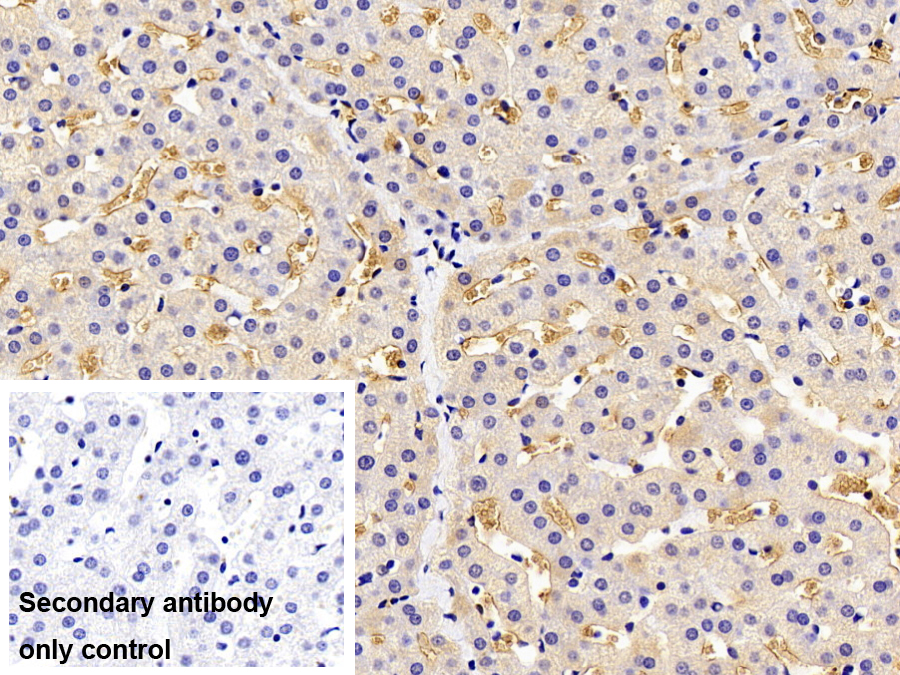 Polyclonal Antibody to Hemoglobin (HB)