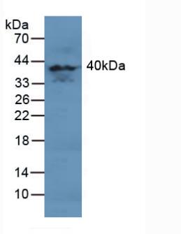 Polyclonal Antibody to Mitogen Activated Protein Kinase 11 (MAPK11)