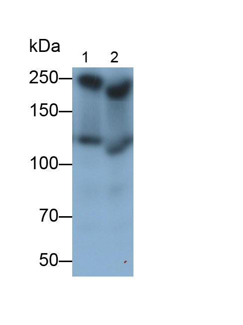 Polyclonal Antibody to Serine/threonine-protein kinase mTOR (mTOR)