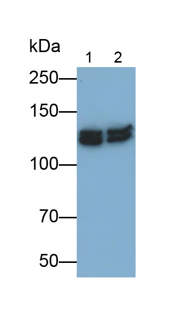 Polyclonal Antibody to Protein Kinase N2 (PKN2)