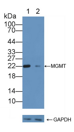 Polyclonal Antibody to O-6-Methylguanine DNA Methyltransferase (MGMT)