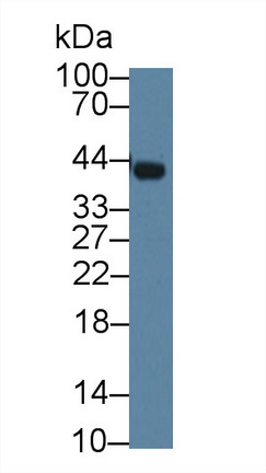 Polyclonal Antibody to Calcium Activated Nucleotidase 1 (CANT1)