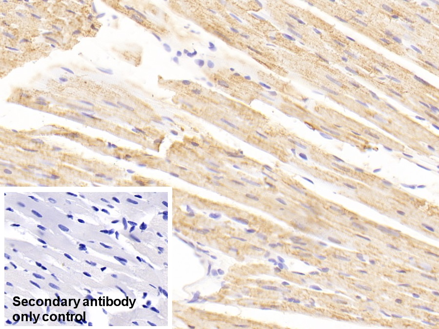 Polyclonal Antibody to Carnitine Palmitoyltransferase 2, Mitochondrial (CPT2)
