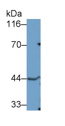 Polyclonal Antibody to Tumor Susceptibility Gene 101 (TSG101)