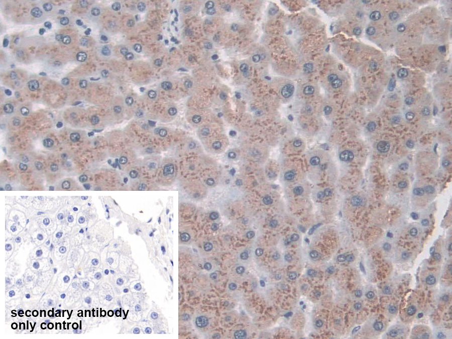 Polyclonal Antibody to Tripeptidyl Peptidase I (TPP1)