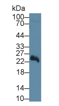 Polyclonal Antibody to 5'-Nucleotidase, Mitochondrial (NT5M)