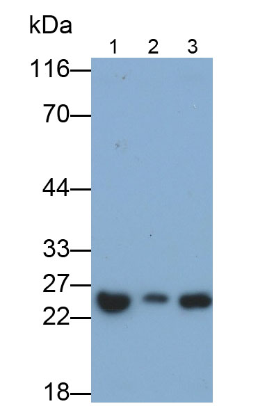 Polyclonal Antibody to Ephrin A5 (EFNA5)