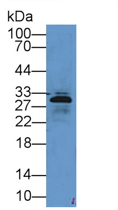 Polyclonal Antibody to Elastase 3B (ELA3B)
