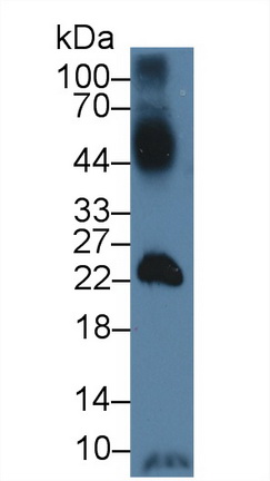 Polyclonal Antibody to Glucose Transporter 14 (GLUT14)