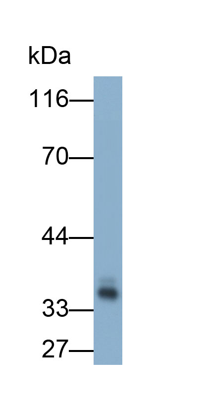 Polyclonal Antibody to Annexin A3 (ANXA3)
