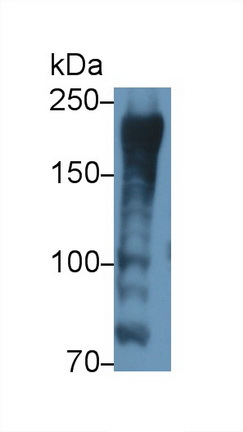 Polyclonal Antibody to A Kinase Anchor Protein 12 (AKAP12)