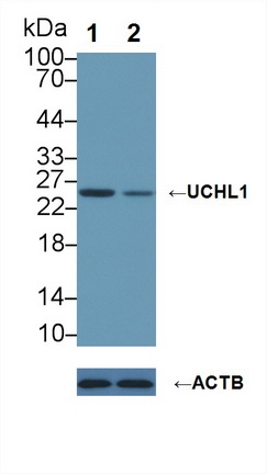 Polyclonal Antibody to Ubiquitin Carboxyl Terminal Hydrolase L1 (UCHL1)