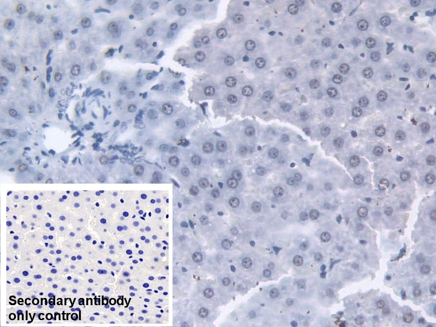 Polyclonal Antibody to Transketolase (TKT)
