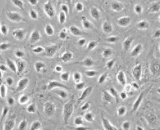 Adrenal Microvascular Endothelial Cells (AMVEC)