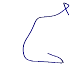 Chemokine Like Factor Superfamily 7 (CKLFSF7)