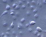 Embryonic Kidney Epithelial Cells (EKE)
