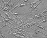 Epidermal Melanocytes (EM)