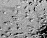 Esophageal Carcinoma Cells (ECC)