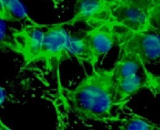 Esophageal Fibroblasts (EF)