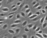 Esophageal Microvascular Endothelial Cells (EMEC)