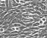 Fetal Dermal Fibroblasts (FDF)