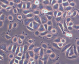 Gastric Cancer Cells (GCC)