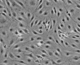 Hepatic Sinusoidal Endothelial Cells (HSEC)