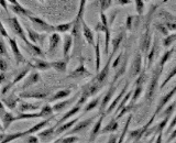 Intestinal Fibroblasts (IF)