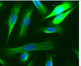 Mammary Epithelial Cells (MEC)