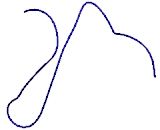 Meteorin Like Protein (METRNL)